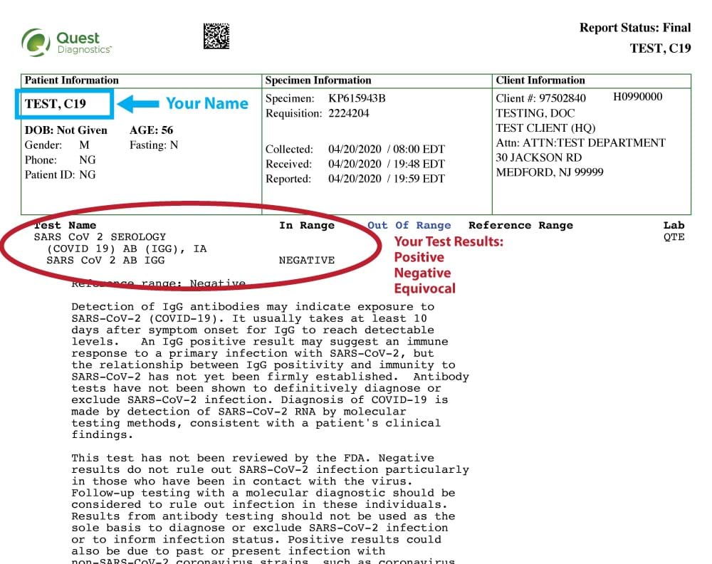 fake negative covid test results template free