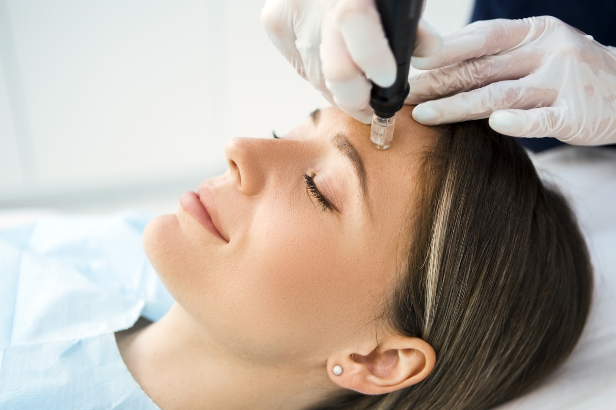 Woman undergoing vampire facial treatment