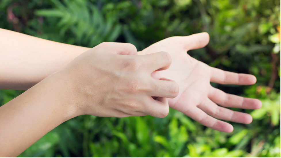 Person with poison ivy rash itching their arm