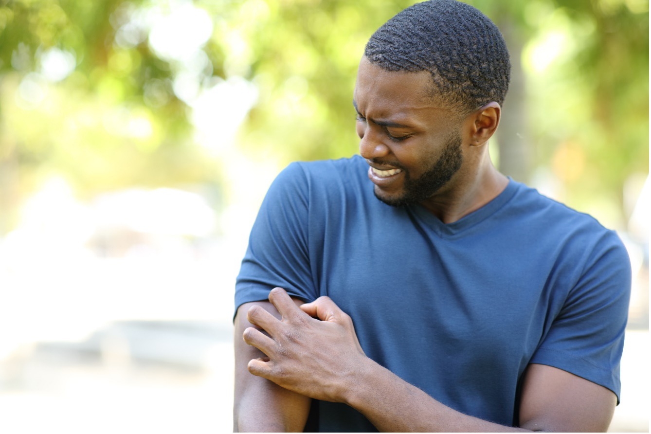 Man scratching heat rash bumps on his arm