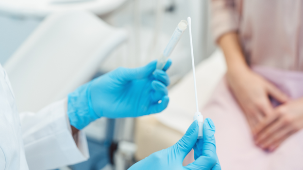 Doctor holding a swab to perform urgent care STI testing