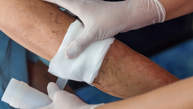 A doctor treating a picture wound.