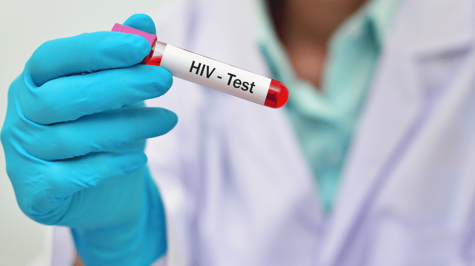 CityMD doctor holding a blood sample labeled HIV test, illustrating the process of HIV testing