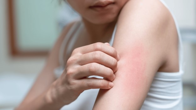 Close-up of a person scratching red, irritated skin on their arm, illustrating symptoms of a rash or hives